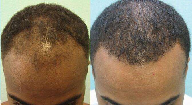 Essence Hair Loss Hair Growth 100% Authentic Essential Oil