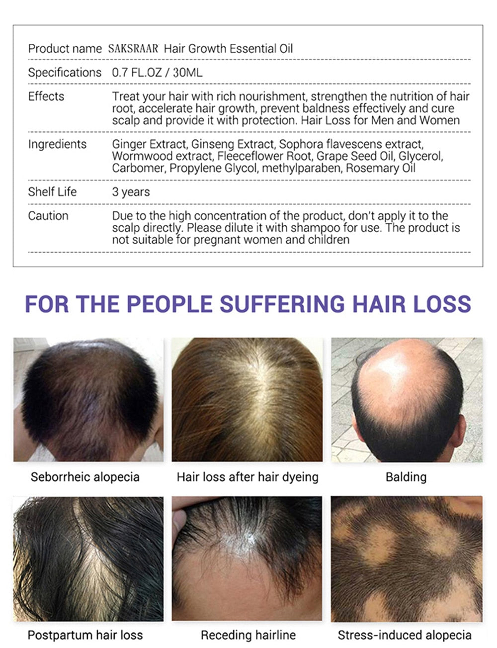 Essence Hair Loss Hair Growth 100% Authentic Essential Oil