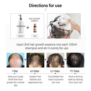 Essence Hair Loss Hair Growth 100% Authentic Essential Oil