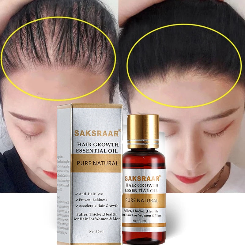 Essence Hair Loss Hair Growth 100% Authentic Essential Oil