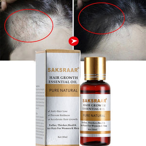 Essence Hair Loss Hair Growth 100% Authentic Essential Oil